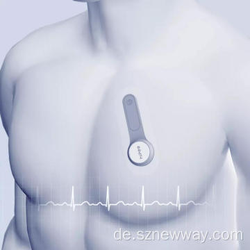 Hipee Smart Electric Dynamic EKG-Recorder